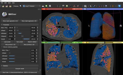 3D Slicer image computing platform - coolestguyplanet.net