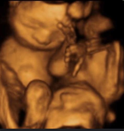 3D Twin Scan: Common Challenges in Building 3D Scanning and How to Overcome Them image 1