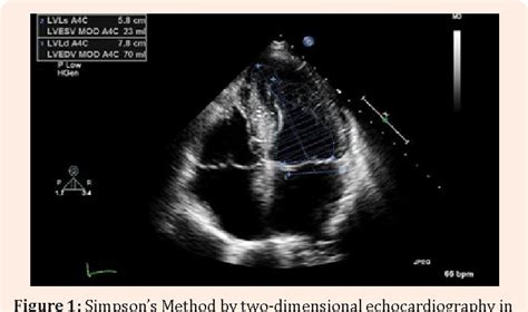 3D transthoracic echocardiography for left ventricular assessment …