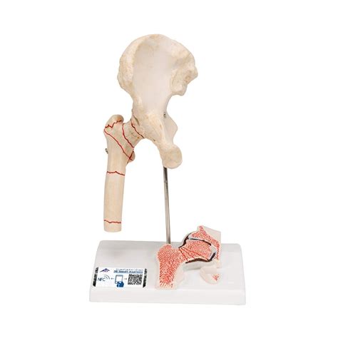 3b scientific a88 modelo de anatomia humana fract