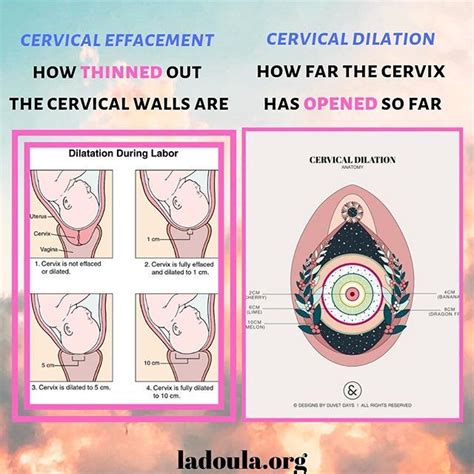 Products and services Cervical effacement and dilation During the first stage of labor, the cervix opens (dilates) and thins out (effaces) to allow the baby to move into the birth canal. In figures A and B, the cervix is tightly closed. In figure C, the cervix is 60% effaced and 1 to 2 cm dilated.. 