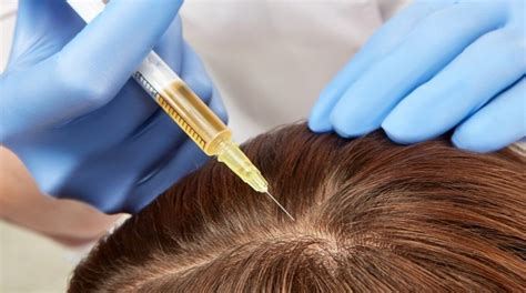 4 New, Effective Hair-Loss Treatments Discovered in 2024