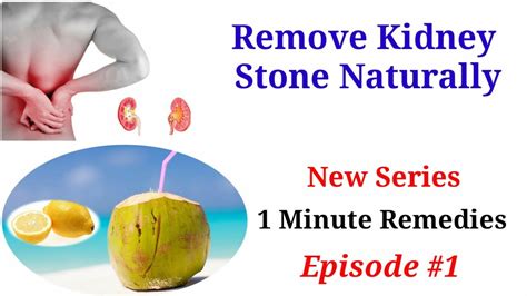 4 Remedies to Dissolve Kidney Stones… But Only One Works