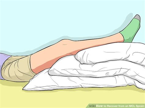 4 Ways to Recover from an MCL Sprain wikiHow