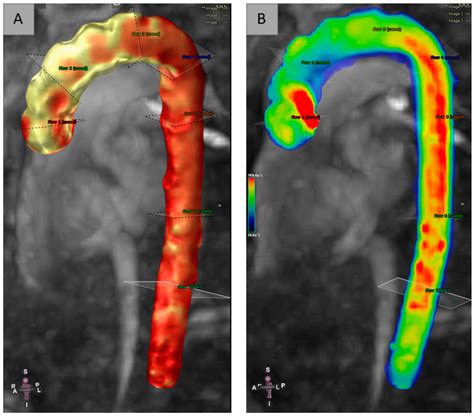 4D Flow MRI Courses Radiology 4D Lab Web Site