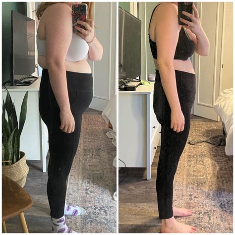 5 6 140 lbs female. 5'5" 140 lbs. Post-op 300 cc 34 C. 5'4" 145 lbs. Post-op 400 cc 34 D. Patients with Sagging Breasts with Augmentation and Breast Lifts. 5' 5", 125 lbs. 34 B. Post-op ... 