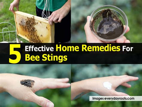 5 Effective Home Remedies for Bee Stings Everyday Roots