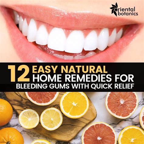 5 Ways to Treat Bleeding Gums at Home