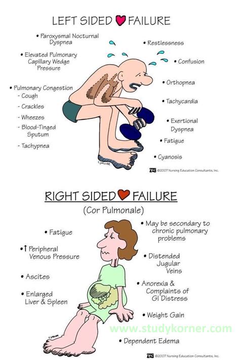 5. Forward failure symptoms (left- and right-sided) in heart failure