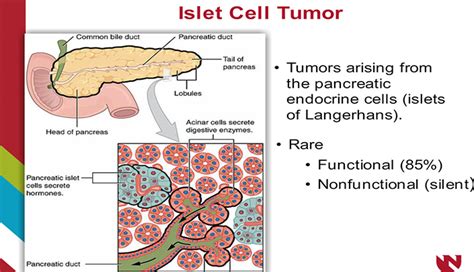 6 Islet Cell Tumors of the Pancreas