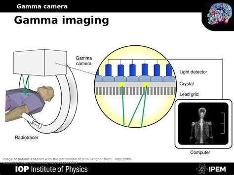 6.12.2 Gamma Camera - Save My Exams