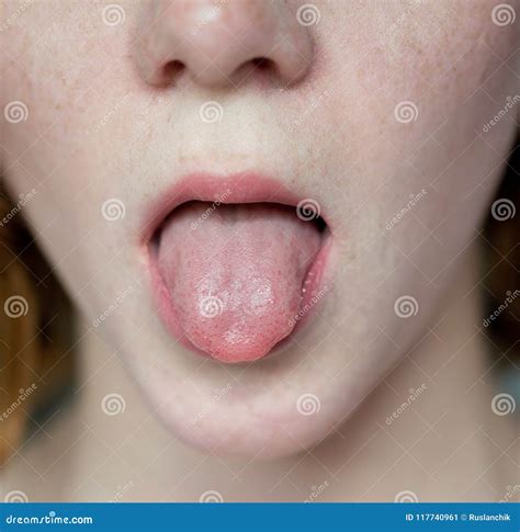 60,610 Healthy Tongue Images, Stock Photos