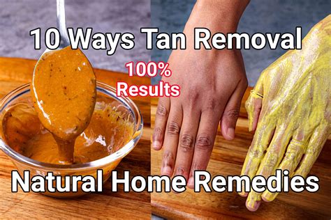 7 Best Home Remedies to Remove Sun Tan Naturally - AK Clinics