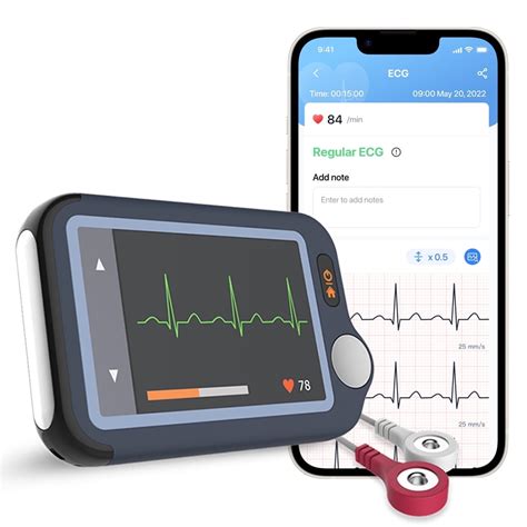 7 Devices to Monitor Heart Health - Caring Senior Service - coolestguyplanet.net