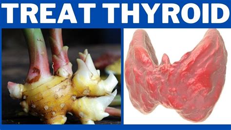 7 Natural Remedies to Cure Thyroid at Home - PharmEasy