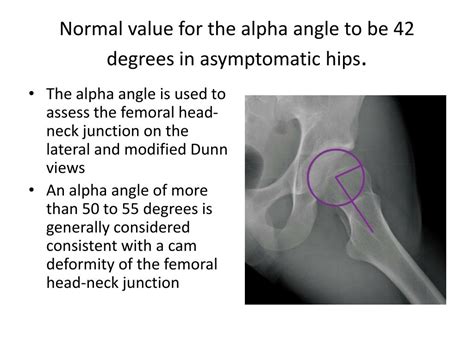 7 Degrees Of Alpha A Collection Of Seven New Bwwm