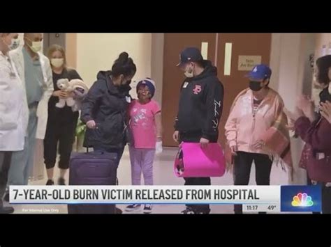 7-year-old girl critically hurt in Oxnard fire leaves burn unit