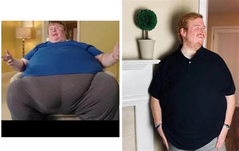 711-Pound Man Refused To Shed Pounds, Claimed "I