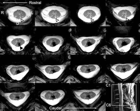 7T MRI research in neurology: initial results and future