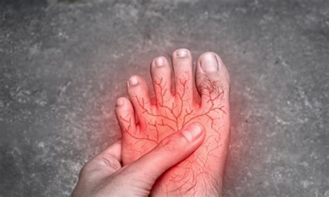 8 Things That Make Neuropathy In the Hands or Feet Worse