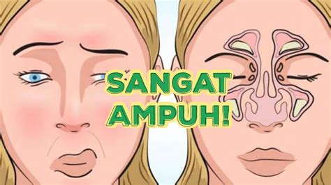 8 Cara Mengatasi Hidung Tersumbat Yang Mudah Dan Cara Mengatasi Hidung Tersumbat Saat Menangis - Cara Mengatasi Hidung Tersumbat Saat Menangis