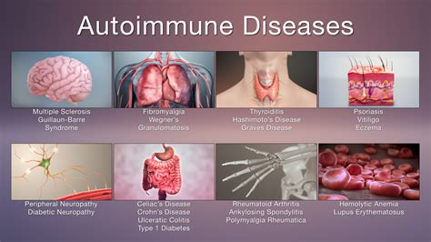 8.7: The Immune System and Disease - Chemistry LibreTexts - muktibox.com