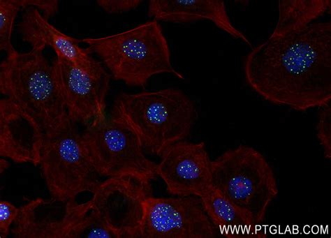 84012 Halı ve Koltuk Yıkama