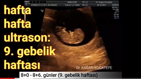 9 haftalık bebek görüntüsü video