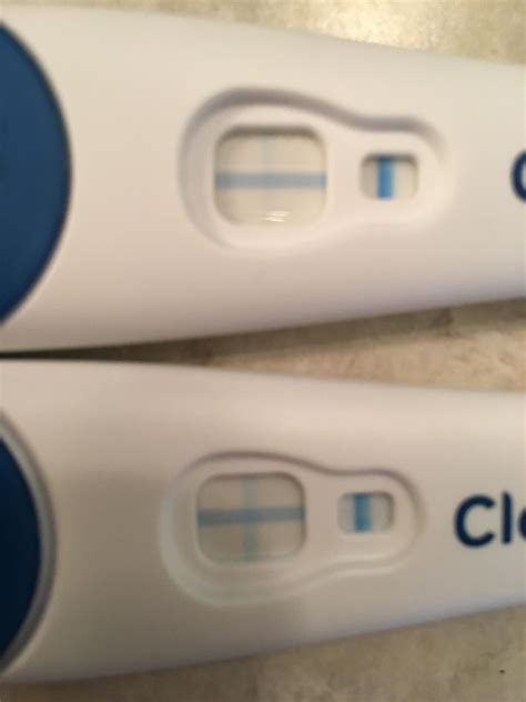 Aug 16, 2013 · I just had my beta today at 9 days past a 5 day embryo transfer for IVF#3 (so 14dpo) and it was only 21. I had the same low hCG with my first IVF cycle last year, started low and not doubling (16 on 12 dpo, 22 on 16 dpo), then doubled correctly, then slowed again, and finally I ended up m/c'ing in my 10th week. . 