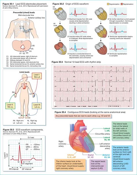 A 12 lead electrocardiogram ECG ppt
