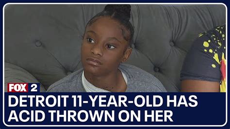 A 12-year-old is facing charges for allegedly throwing acid on an 11-year-old girl at a Detroit playground, officials say