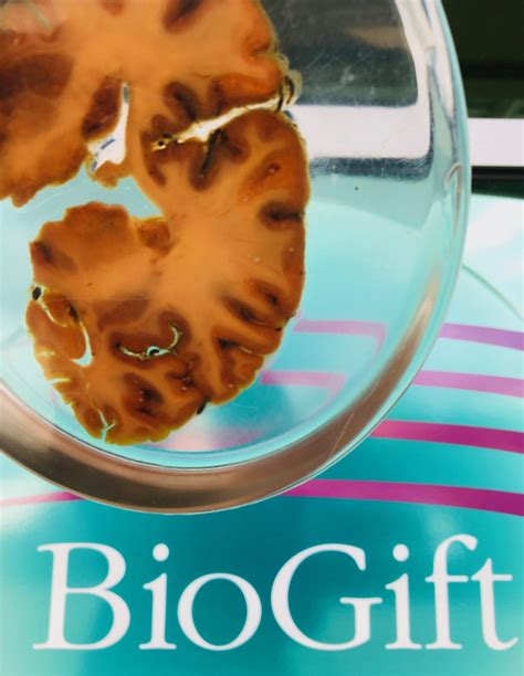 A BioGift of Brains – NW NOGGIN: Neuroscience outreach group …