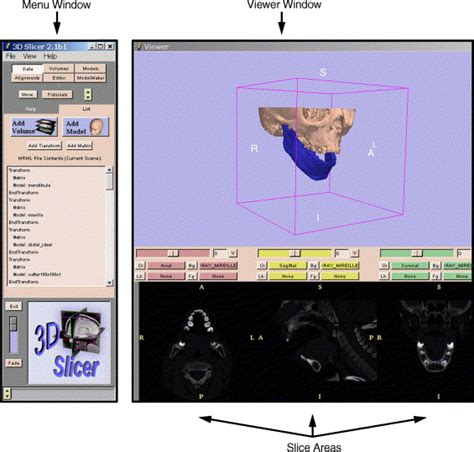 A Computer Assisted Approach to Planning Multidimensional Distraction Osteogenesis