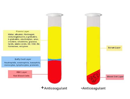 A Guide to Hematology Testing Centrifuges - Labcompare - wintechmobiles.com