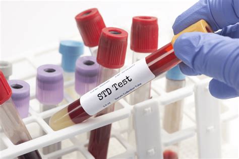 A Guide to STI/STD Testing Park Med NYC