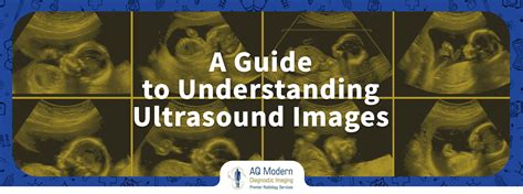 A Guide to Understanding Ultrasound Interpretations