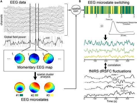 A High Resolution EEG Study of Dynamic Brain Activity