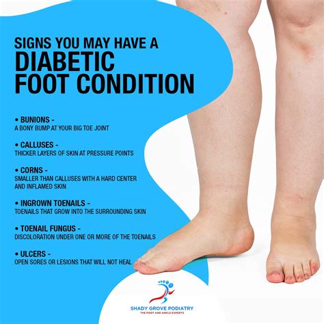 A Look at the Main Causes and Symptoms of Diabetic Foot Pain - …