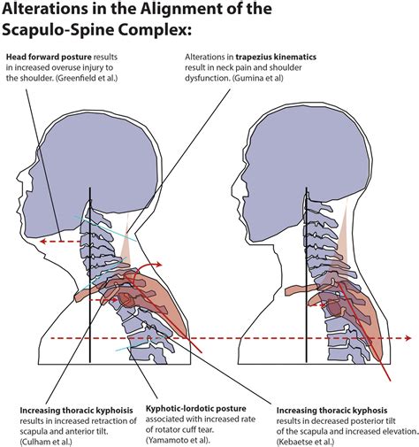 A Nationwide Review of the Associations Among Cervical Spine