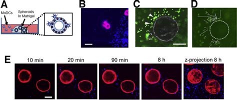 A Novel Gastric Spheroid Co-culture Model Reveals