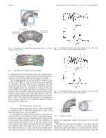 A Novel Magnetic Gear With Intersecting Axes