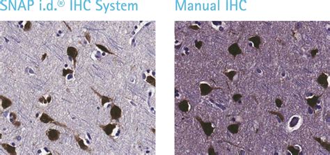 A Novel Method for Streamlined Immunohistochemistry