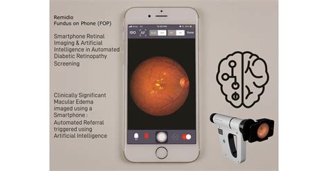 A SMARTPHONE-BASED SYSTEM FOR AUTOMATED DETECTION …