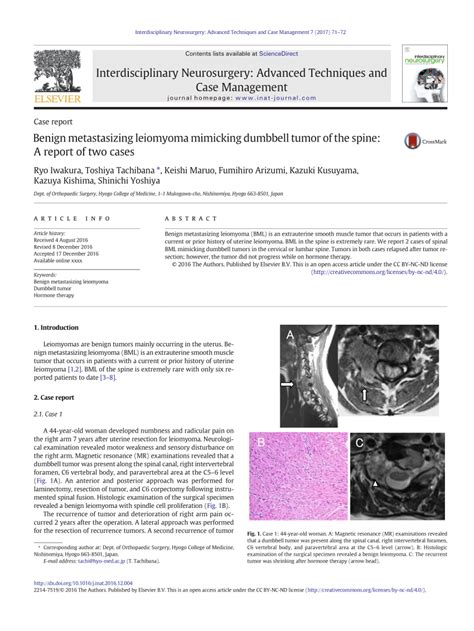 A case report of Benign metastasizing leiomyoma