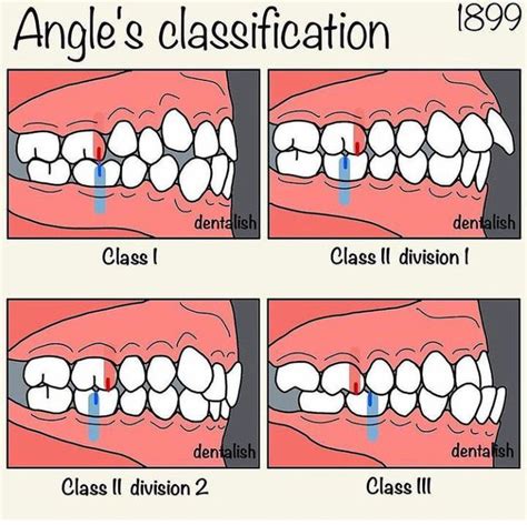 A clinical guide to occlusion