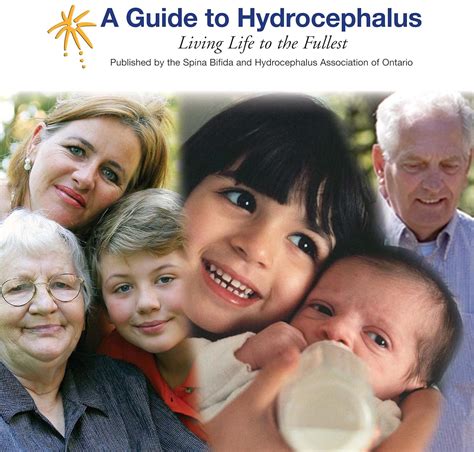 A guide to hydrocephalus living life to the fullest. - 2009 polaris ranger rzr 170 atv service repair workshop manual.