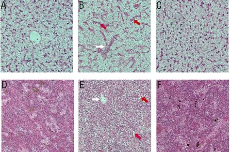 A live attenuated strain of HY9901ΔdctP provides