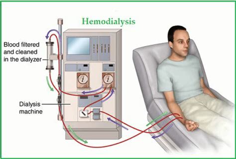 A patientaeurtms guide to dialysis and transplantation. - Hustler fastrak kohler 15 ps motor handbuch.