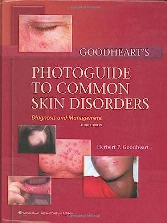 A photoguide of common skin disorders diagnosis and management. - Manuale della lavatrice bosch exxcel 1600 express.