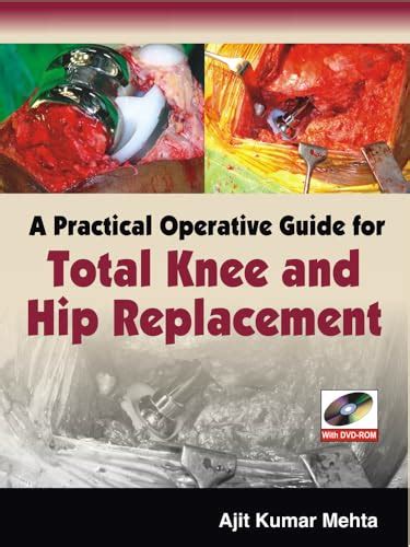 A practical operative guide for total knee and hip replacement. - A manual of prayers by c c p.